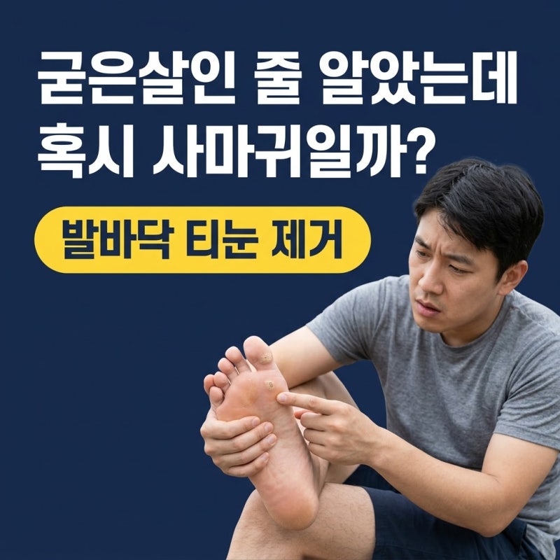 발바닥티눈제거, 아픔 참지 말고 굳은살 사마귀와 구분하는 법