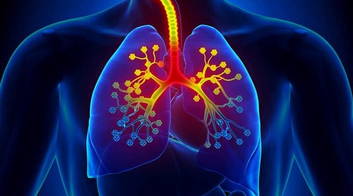 급성 기관지염(Acute bronchitis) – 원인, 증상, 진단, 치료, 예방법까지