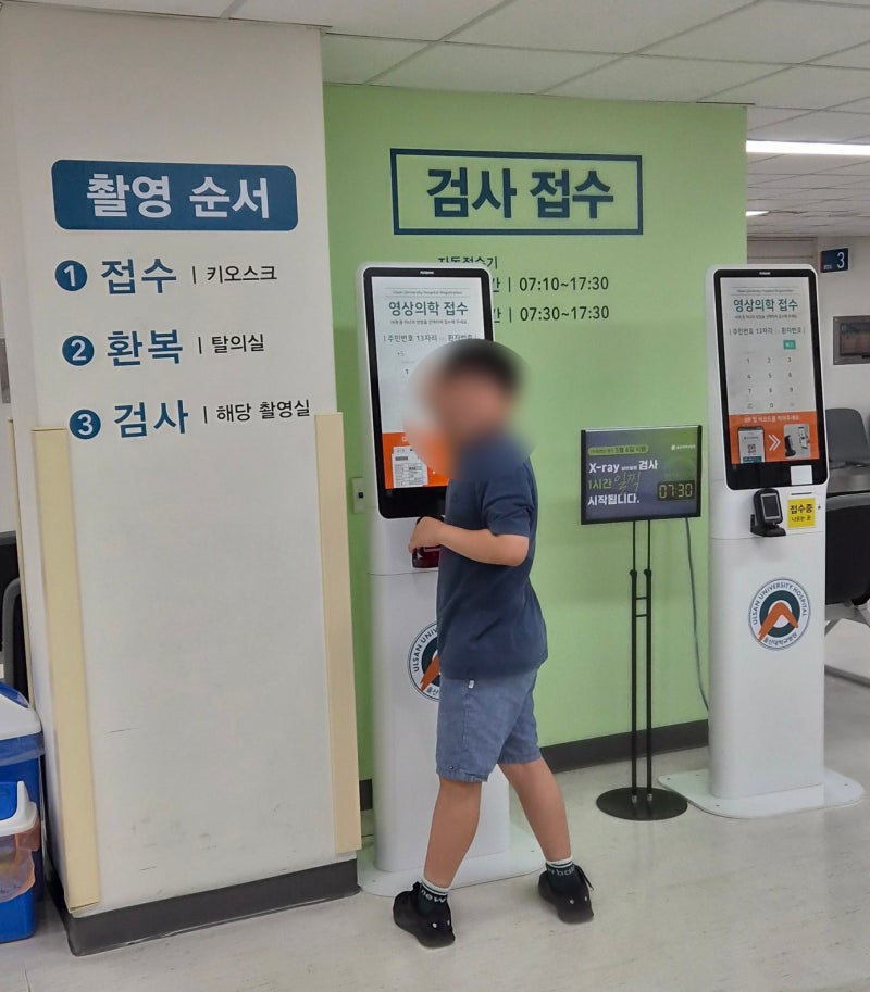 울산대학교병원, 성조숙증 치료 2년 차(24개월) 초등학교 남자 5학년(만 10세 6개월)