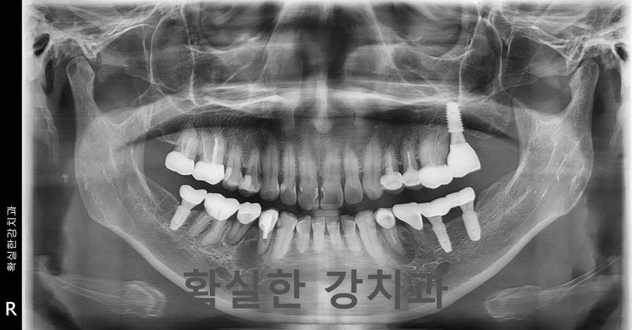 확실한강치과의원 사진 4