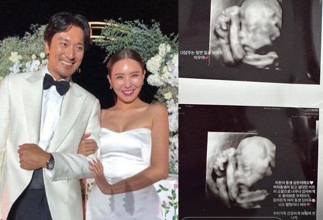 지드래곤 조카 딸이었다... 권다미가 공개한 초음파 사진에 다들 "이 부분 봤어?"