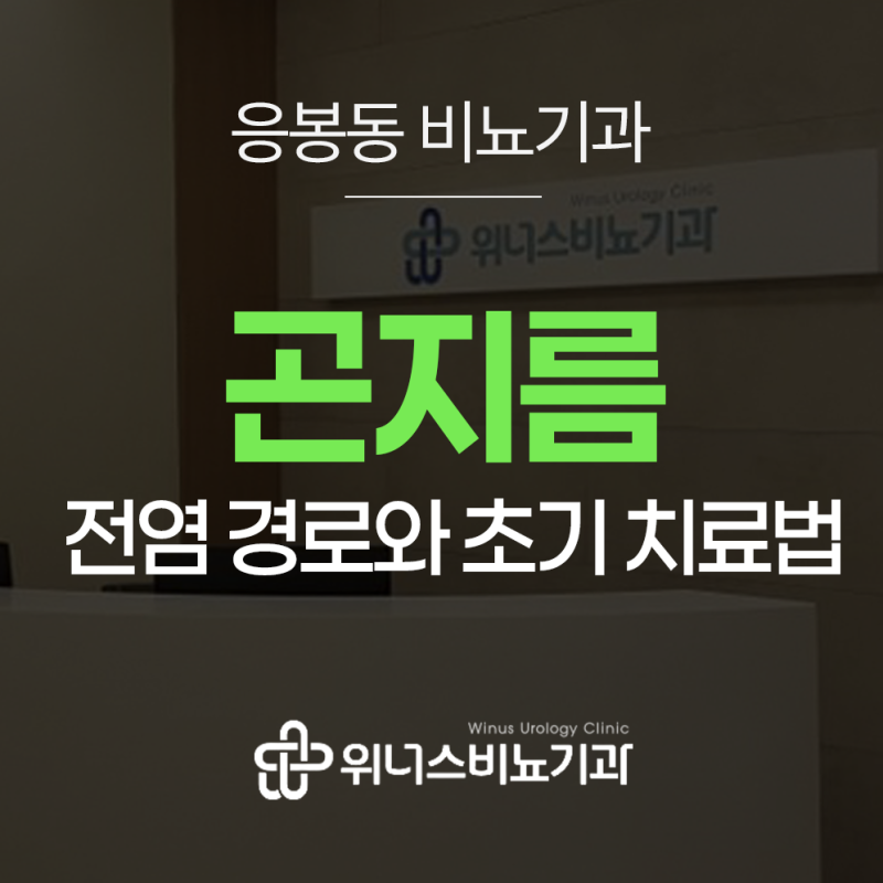 응봉동 곤지름전염 경로와 초기 치료 방법은