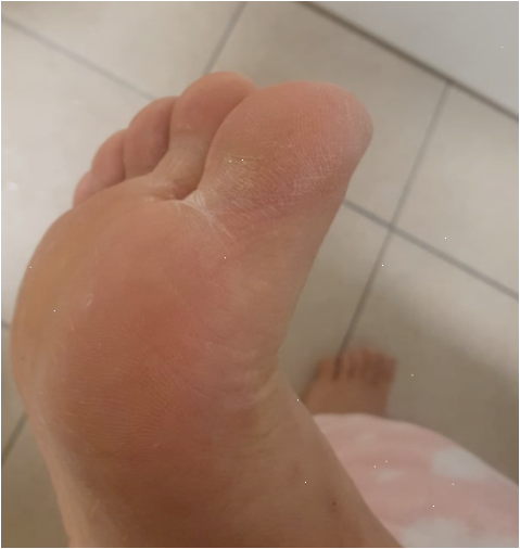 케라좀내돈내산 피부과에서 듣고 바로 갈아탄 이유