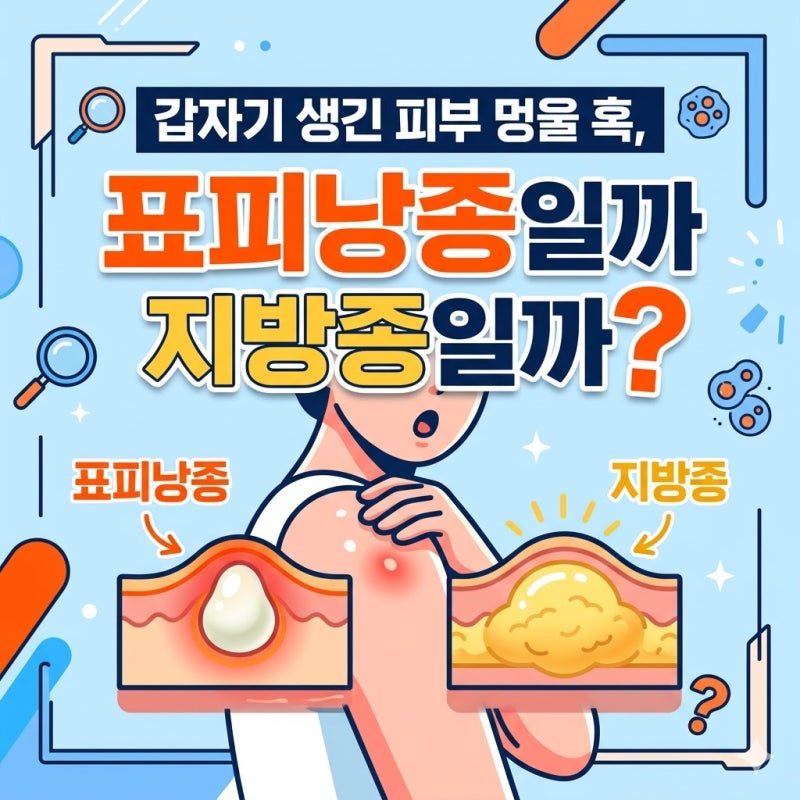 피부 멍울 표피낭종 지방종 차이 수술 후 관리법