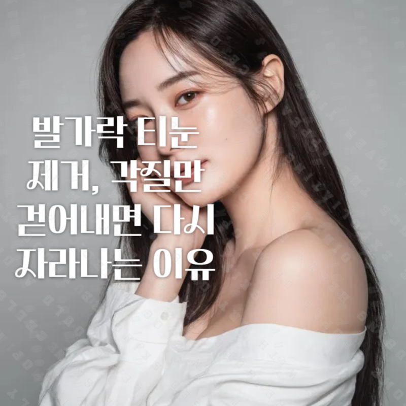 발가락 티눈 제거, 각질만 걷어내면 다시 자라나는 이유