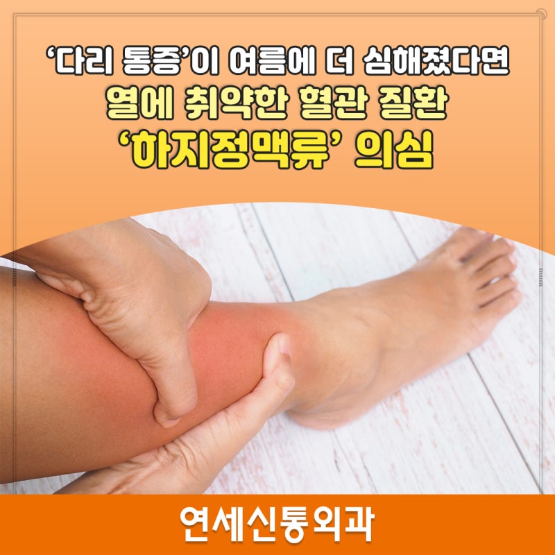 [과천 하지정맥류 병원] ‘다리 통증’이 여름에 더 심해졌다면 열에 취약한 혈관 질환 ‘하....