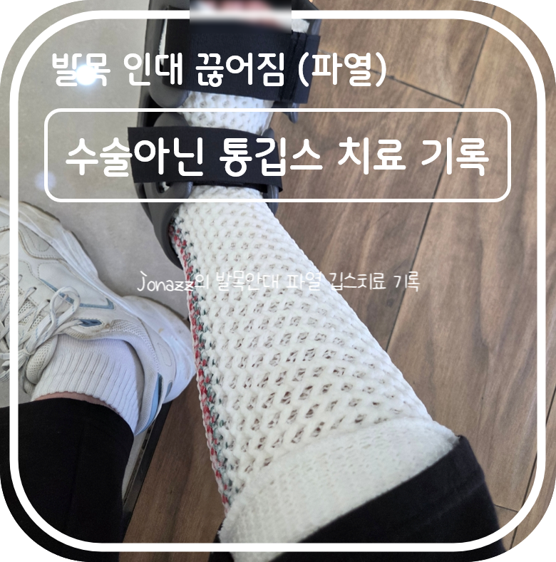 발목 인대 끊어짐(파열) 수술 아닌 깁스 치료 (1~4주차) 기록