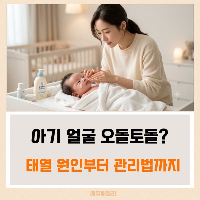 신생아 태열 관리, 두피 각질 완벽 타파! 초보 맘을 위한 필수 가이드