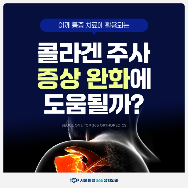 상동역정형외과, 회전근개파열 시 콜라겐주사 효과는?
