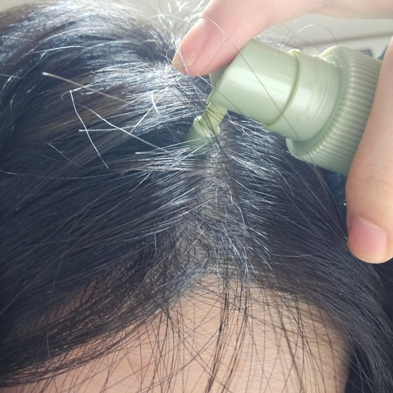 탈모앰플 추천 현대약품 마이녹셀 인텐시브 스칼프 앰플토닉 헤어토닉