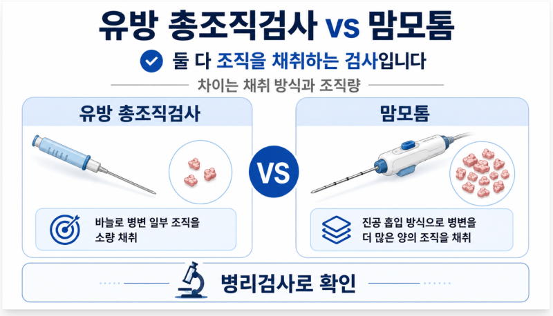 유방 총조직검사와 맘모톰 차이, 어떤 검사를 하게 될까?
