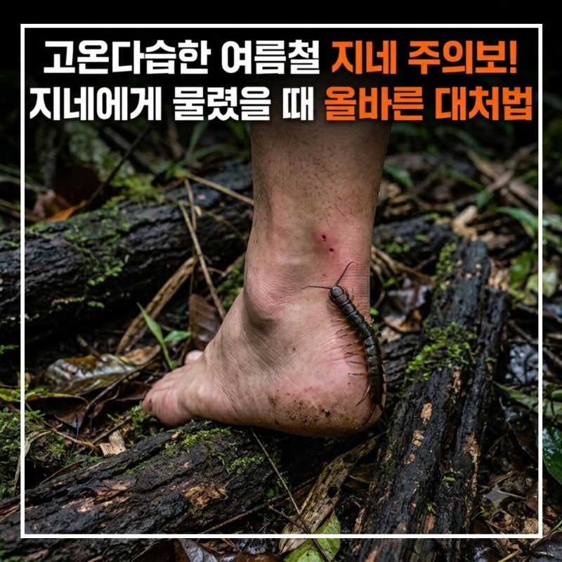 고온다습한 여름철 지네 주의보! 지네에게 물렸을 때 올바른 대처법