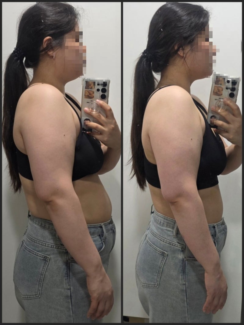 스위치온 다이어트 3일차 후기｜3일 만에 몸에 생긴 변화
