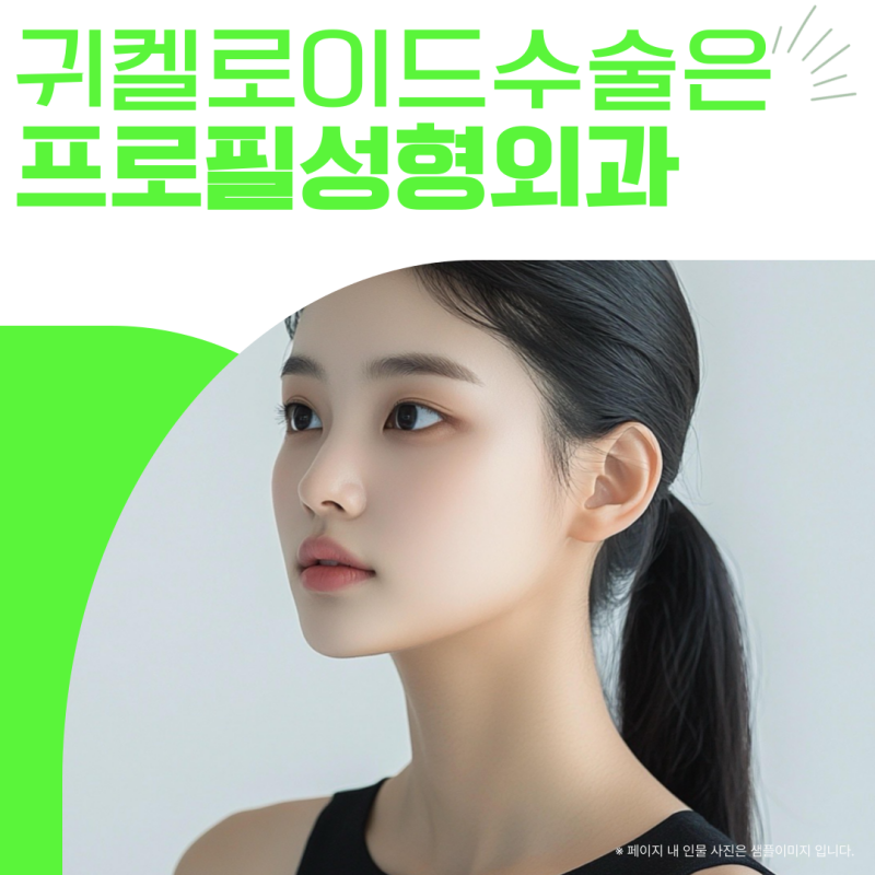 귀켈로이드 수술 한달차 변화와 실비보험 청구 기준