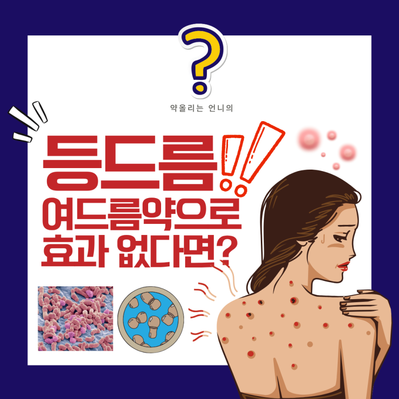 등드름, 여드름약 발라도 안 낫나요? 곰팡이가 원인일 수 있어요 (말라세지아 모낭염)