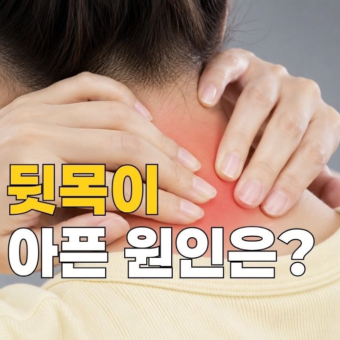 목 디스크? 흉곽출구증후군일 수 있습니다 원인 증상 총정리