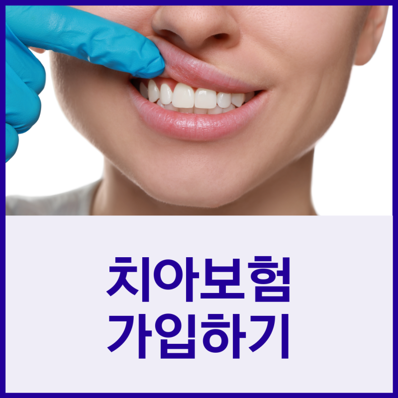 치아보험비교사이트로 내게 필요한 보장내용을 중점적으로 설계해보세요