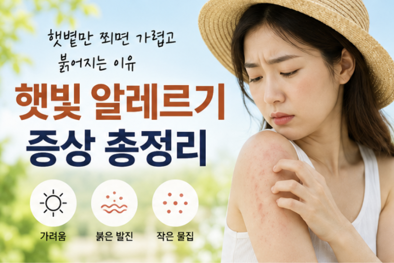 햇빛 알레르기 증상 총정리 햇볕만 쬐면 가렵고 붉어지는 이유