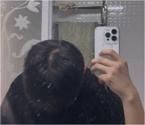 댄트롤샴푸 비듬은 잡혔는데 숱이 자꾸 빠져서 갈아탄 썰
