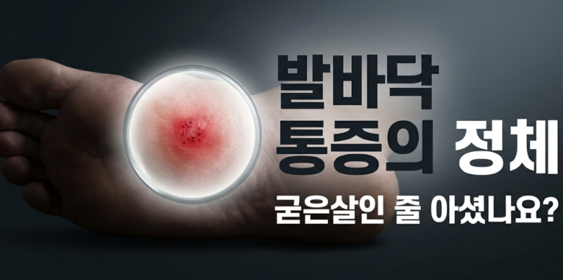 여름철 발바닥 통증 원인, 티눈 사마귀 차이점과 베루말 올바른 사용법
