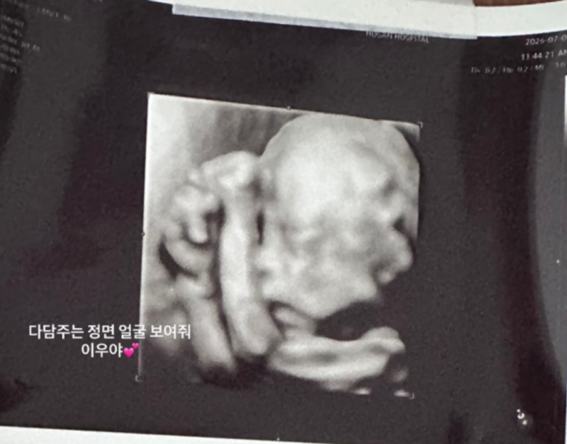이든이 여자 동생 생긴다, 지드래곤 조카 탄생, 권다미 김민준 둘째 임신