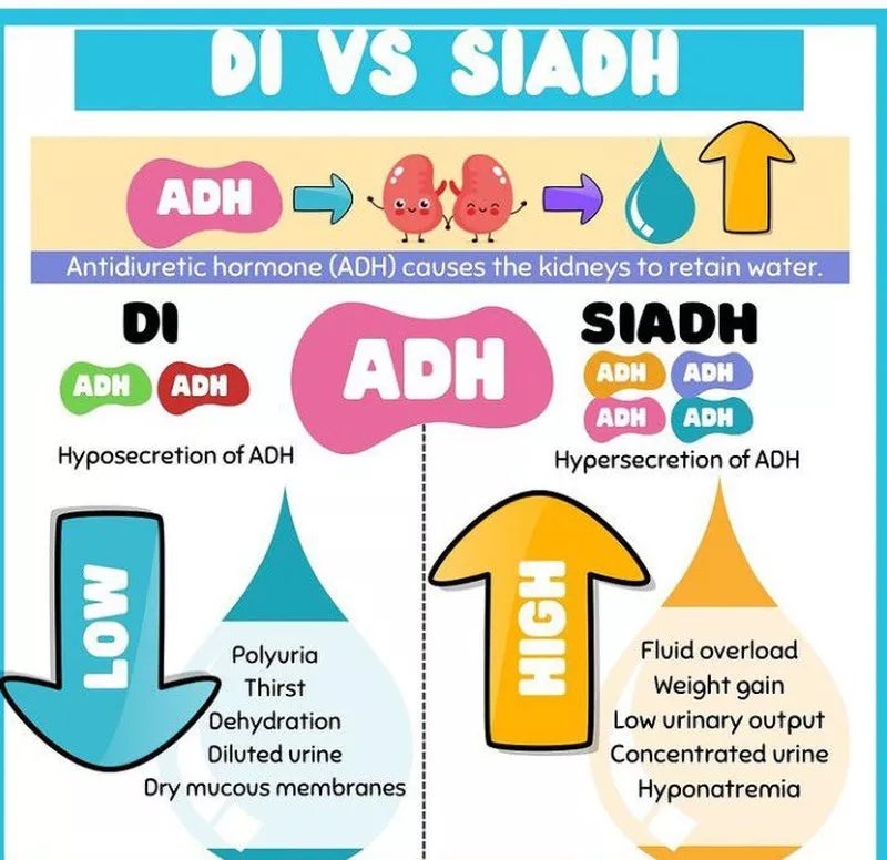SIADH vs 요붕증(DI), 어떻게 다를까?