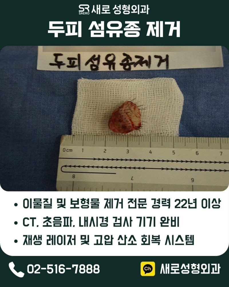 피부섬유종 제거 실비, 성형외과에서 가능할까요?