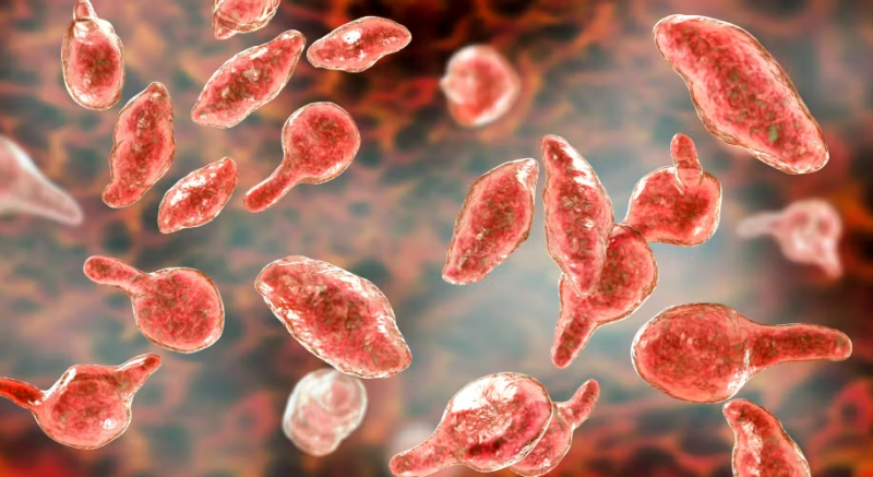 사상산부인과 Mycoplasma genitalium(MG, 마이코플라스마 제니탈리움)의 진단 치료 감염경로 추적검....