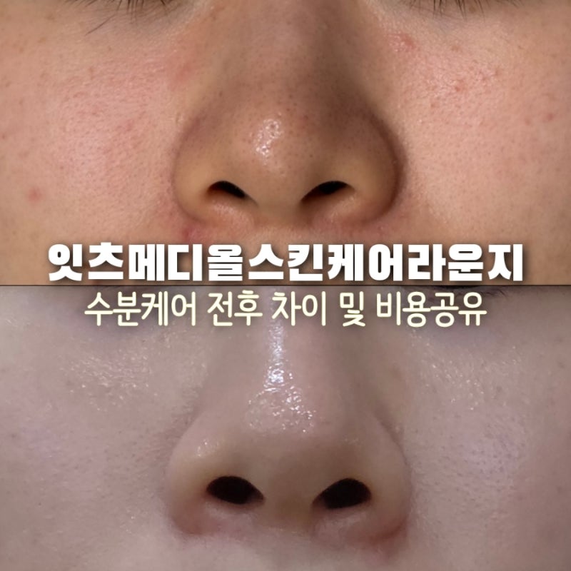 [창원 피부관리 추천] 잇츠메디올스킨케어라운지ㅣ수분보충케어 후기, 홍조·트러블 피부관....