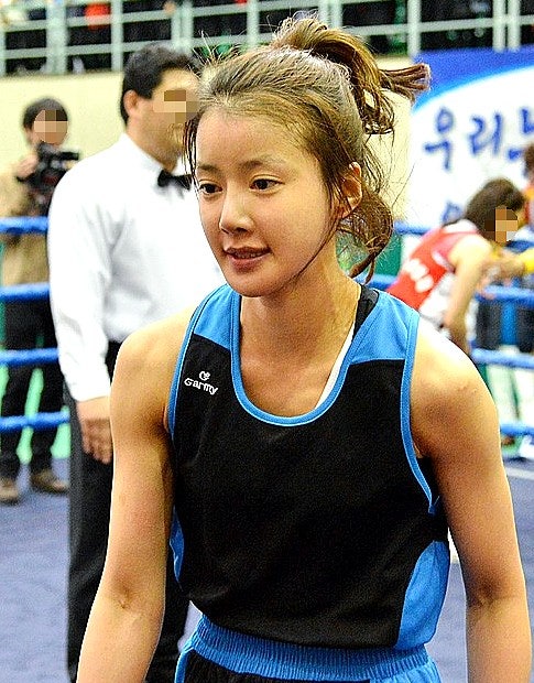 "성형 고백도 당당하게!" 한때 연예계 발칵 뒤집었던 5천만 원 루머설보다 더 놀라운 "국가 대....