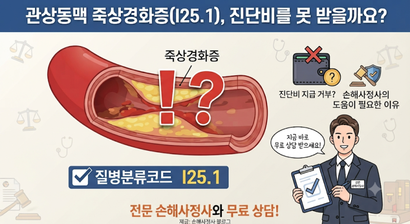 관상동맥 죽상경화증(I25.1), 협착률이 50% 안 되면 진단비를 못 받을까요?