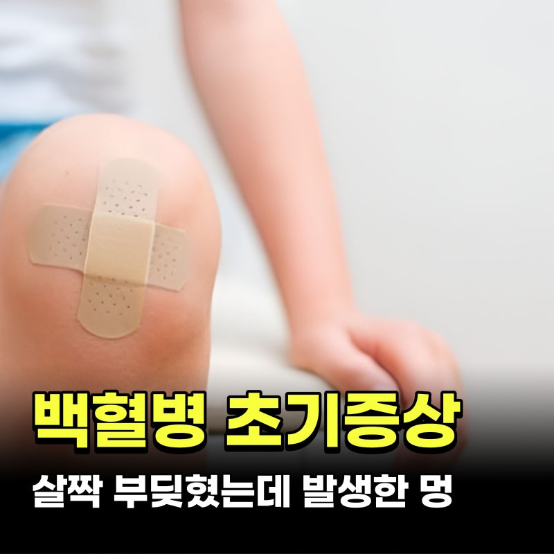 백혈병 초기증상 4가지.. 살짝 부딪혔는데 생긴 멍과 만성피로