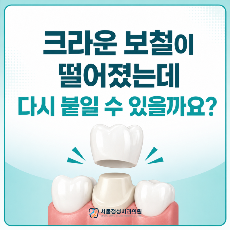 독산역치과 크라운 보철이 떨어졌는데 다시 붙힐 수 있을까?