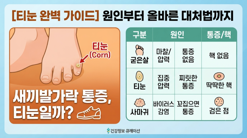 [내궁내찾] 새끼발가락 티눈 통증 해결! 집에서 하는 자가 치료 주의사항