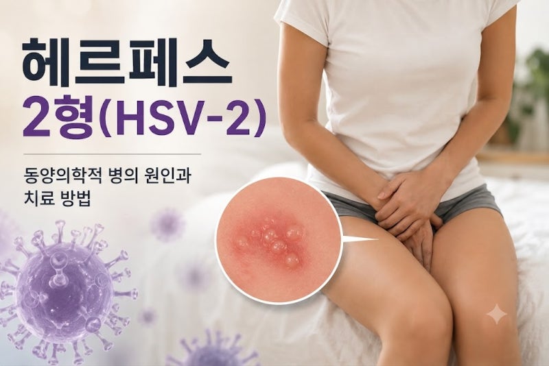 헤르페스 2형(음부포진), 자주 재발하는 이유~면역력 높이는 방법