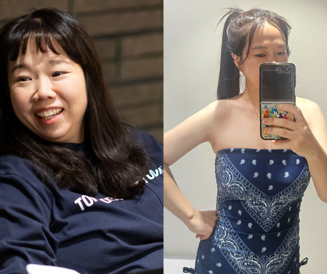 60kg에서 49kg...성형수준 급 다이어트 성공한 개그우먼 '홍현희'
