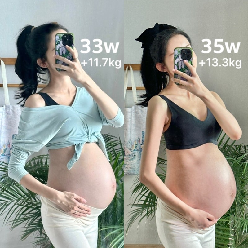 [임신 35주] 임신후기 쌍둥이 막달 증상, 쌍둥이 배크기 변화, 몸무게 13kg 증가, 붓기 튼살 없....