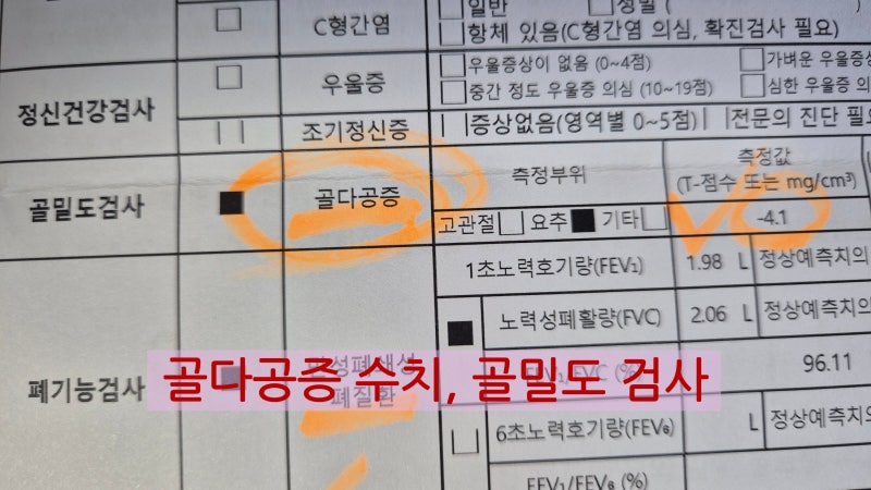 골다공증 수치 -4.1, 얼마나 위험할까? 골다공증 원인부터 치료·골절 예방까지 총정리