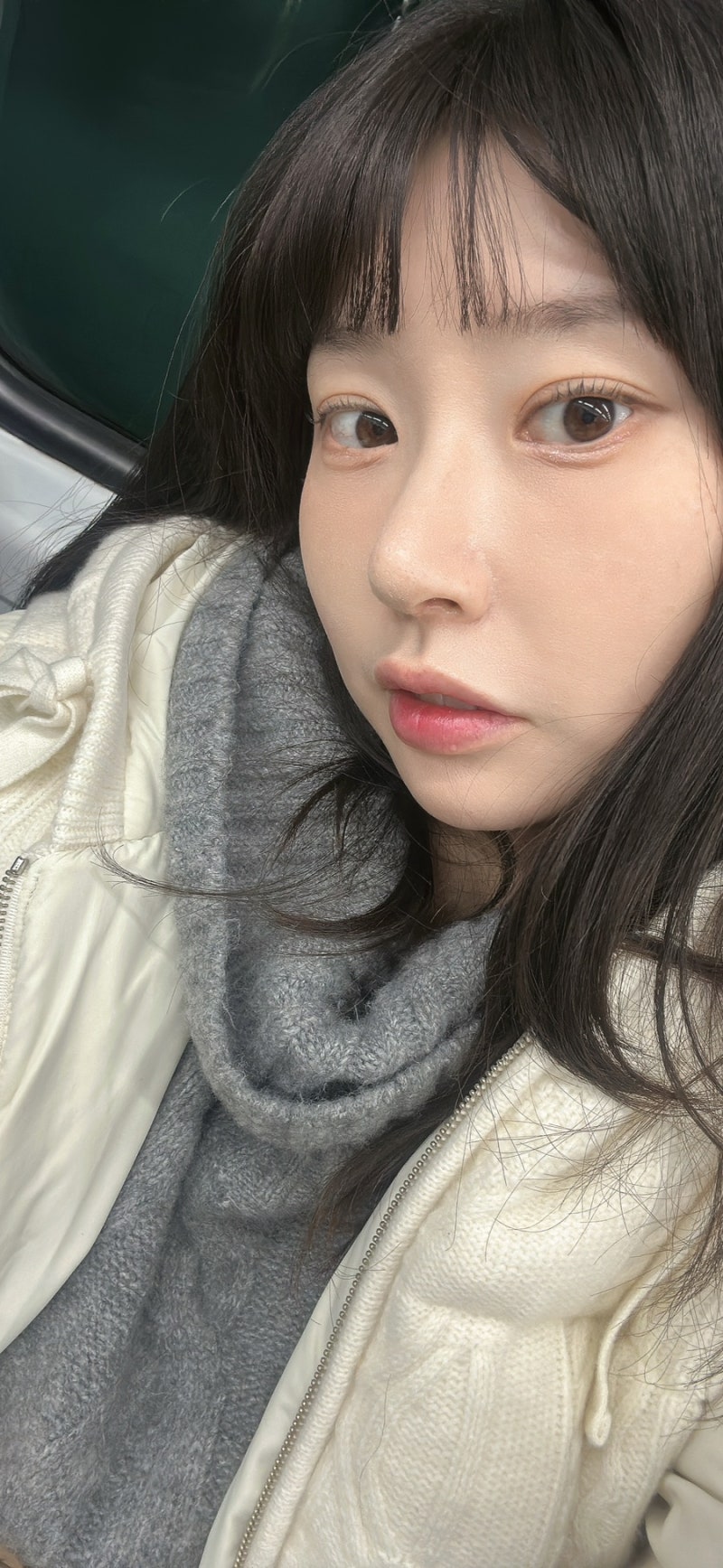 기능코 미용코 무보형물 비중격만곡증 수술 비염수술 솔직후기 + 매부리코수술 부작용
