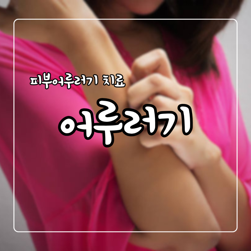 피부 어루러기 증상 치료 겨드랑이 어루러기 연고