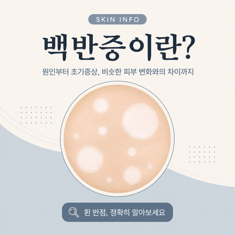 백반증이란? 원인과 초기증상, 비슷한 피부 변화와의 차이까지