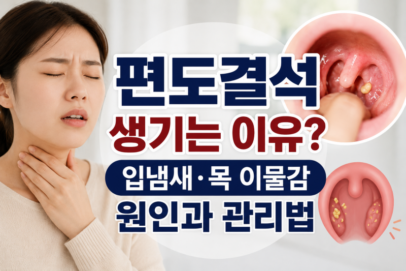 편도결석 생기는 이유? 입냄새·목 이물감 원인과 관리법