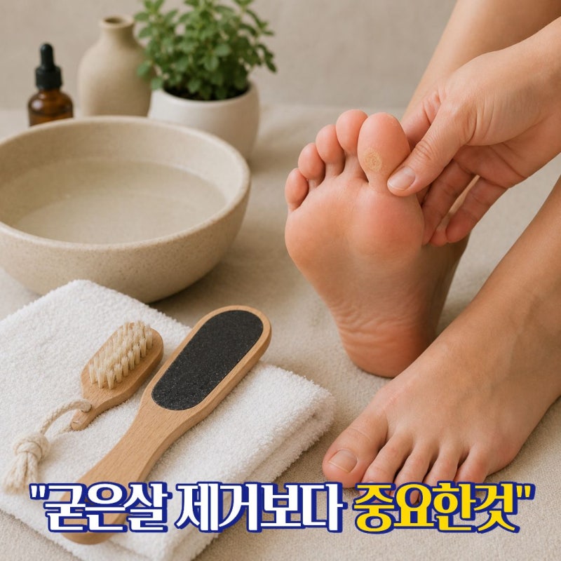 발가락굳은살 제거 같은 자리에 반복되는 이유