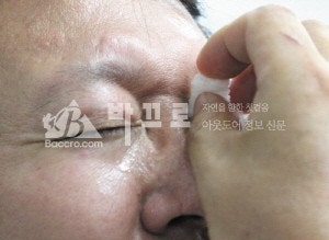 눈에 이물질이 들어갔을 때 응급처치: 각막 상피 손상을 막는 올바른 세척법
