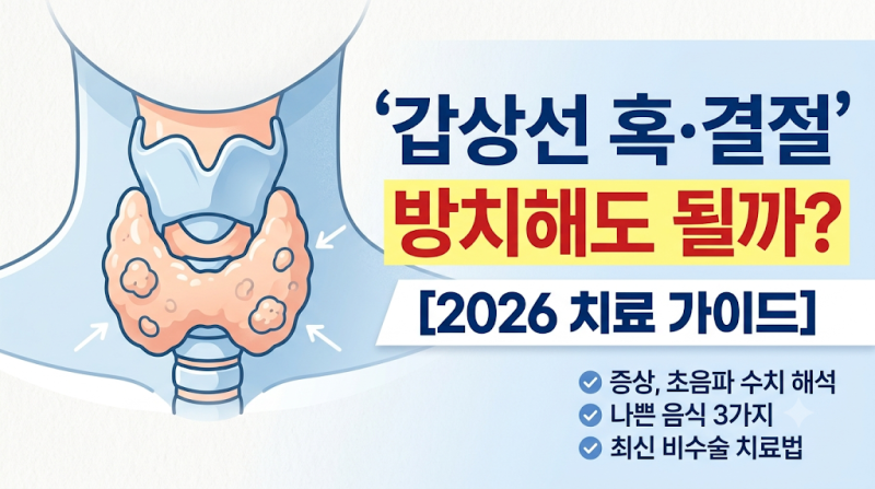 갑상선 혹 결절 방치해도 될까? 2026 최신 치료방법 가이드