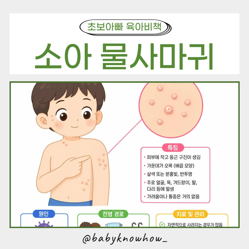 소아 물사마귀 전염될까? 자연치유 가능할까?