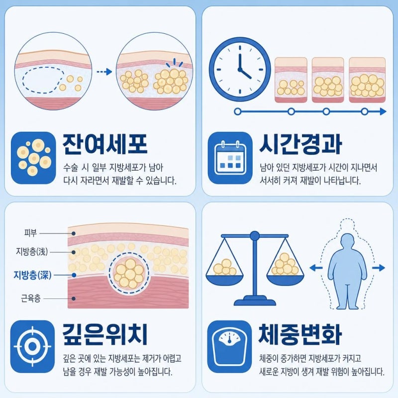 지방종수술 후 재발하는 이유는 뭔가요?