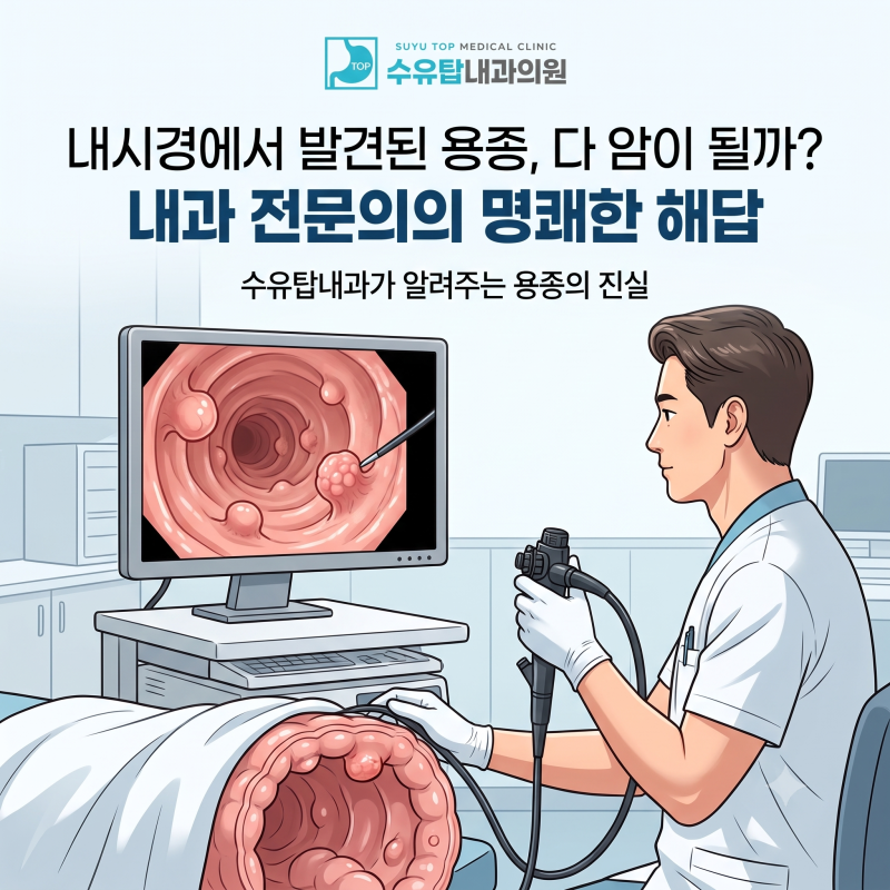 대장 내시경에서 발견된 용종, 다 암이 될까? 내과 전문의가 알려주는 진짜 이야기