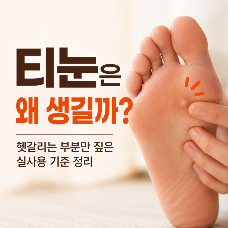 티눈은 왜 생기는 걸까? 헷갈리는 부분만 짚은 실사용 기준 정리