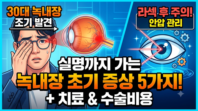 녹내장 증상, 30대 녹내장, 라섹녹내장 (+치료 수술비용)정리
